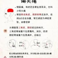 偏头痛针灸调理