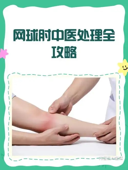 网球肘中医理疗